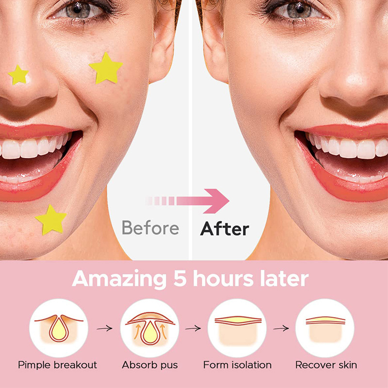 600 قطعة/المجموعة نجمة بثرة ال - مراجعة Beauty Makeup Tools وسعره